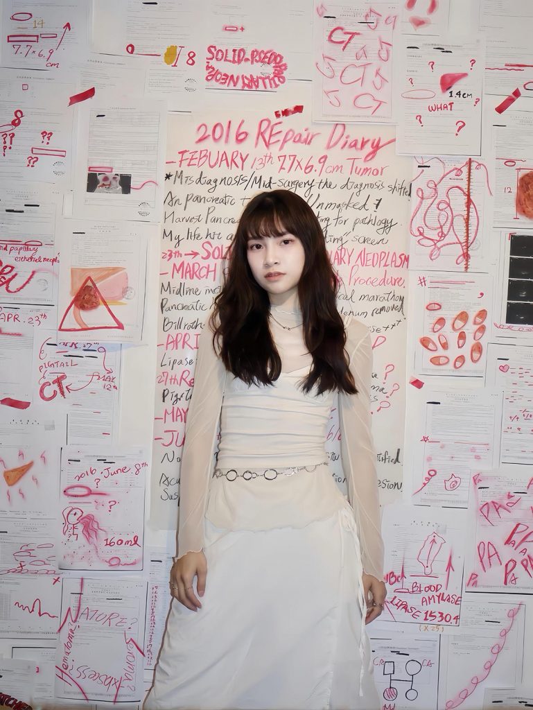 生命與音樂跨界震撼彈!現任女團成員「鹿熙 YUI」肚上有23公分「天使之疤」 2 20260617 NEWS 1 15